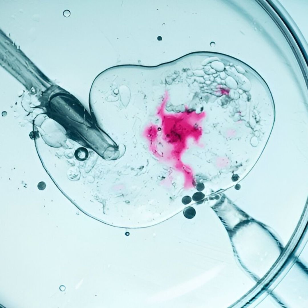 Best IVF Centre in Tirupati