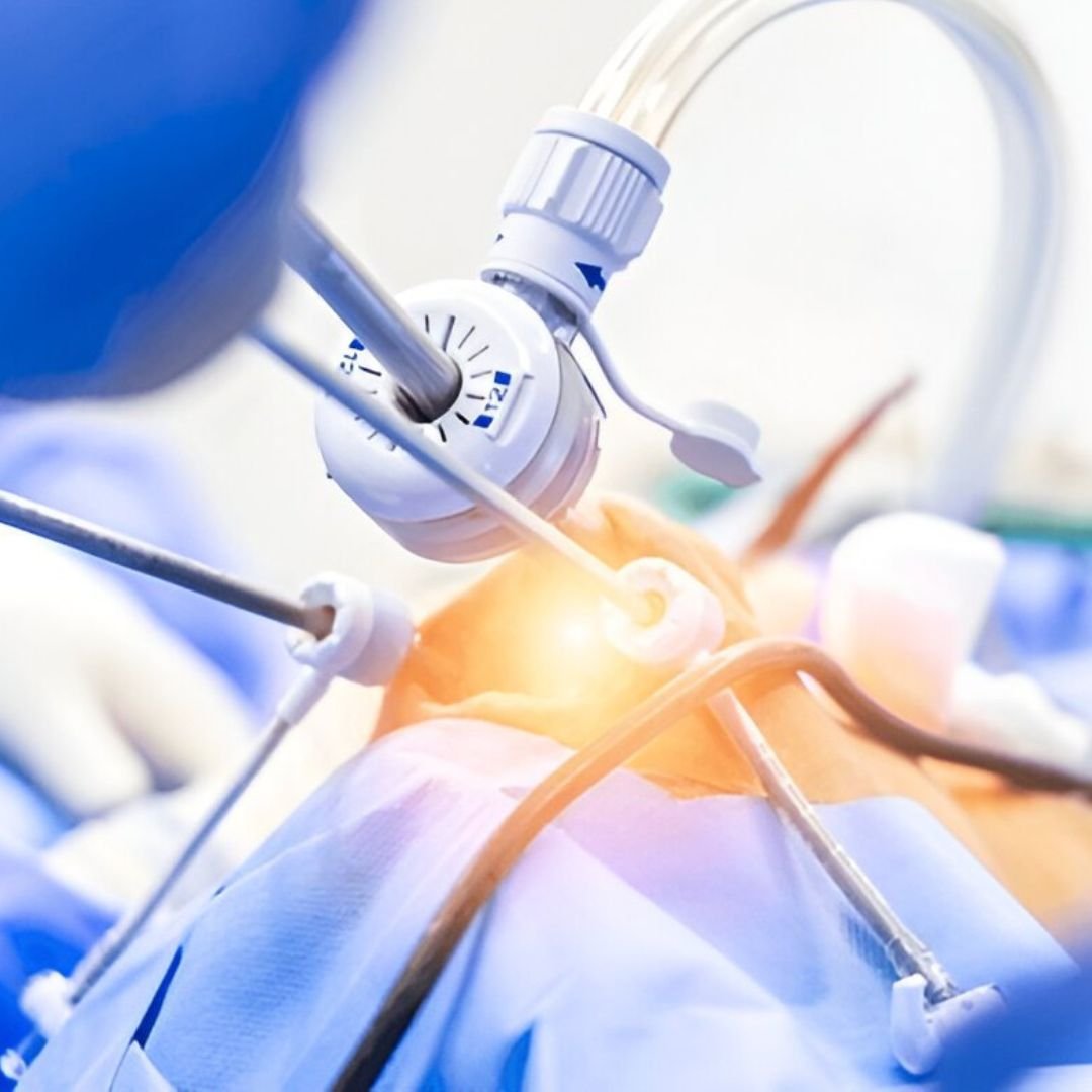Laparoscopic and Hysteroscopic Surgeries in Tirupati